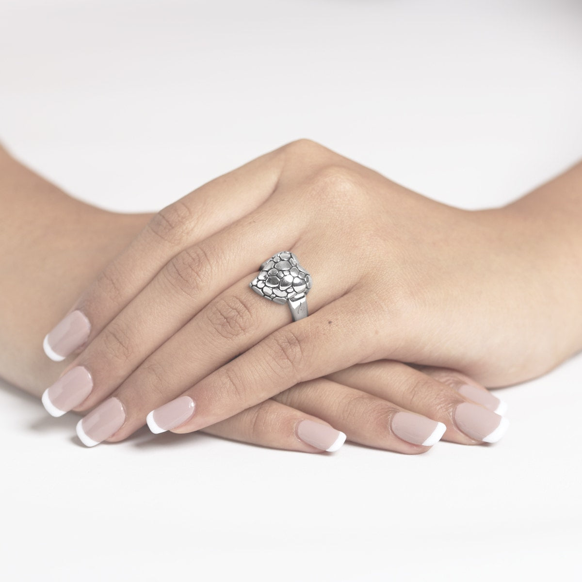 Cobblestone Hinged Rheumatoid Arthritis